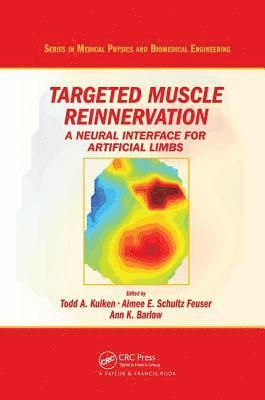 bokomslag Targeted Muscle Reinnervation