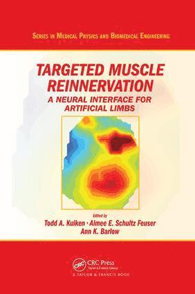Todd A. Kuiken, Aimee E. Schultz Feuser, Ann K. Barlow - Targeted Muscle Reinnervation, Häftad