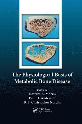 Borje Edgar Christopher Nordin, Howard Arthur Morris, Paul Anderson, South Australia) Nordin, Borje Edgar Christopher (Royal Adelaide Hospital, Adelaide) Morris, Howard Arthur (University of South Australia, Adelaide) Anderson, Paul (University of South Australia - Physiological Basis of Metabolic Bone Disease, Häftad