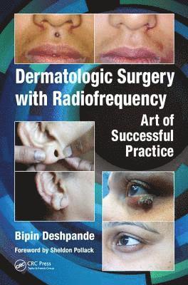 bokomslag Dermatologic Surgery with Radiofrequency