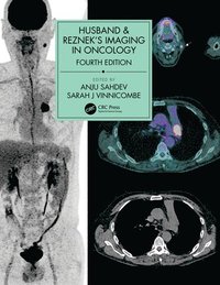 bokomslag Husband & Reznek's Imaging in Oncology