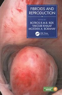 bokomslag Fibroids and Reproduction