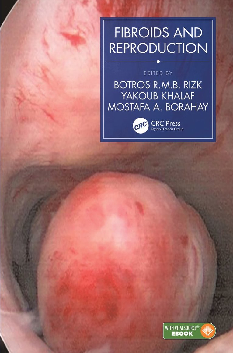 Botros R.M.B. Rizk, Yakoub Khalaf, Mostafa A. Borahay, USA) Rizk, Botros R.M.B. (University of South Alabama, UK) Khalaf, Yakoub (Guy's and St Thomas' NHS Trust, Botros R. M. B. Rizk - Fibroids and Reproduction, Inbunden
