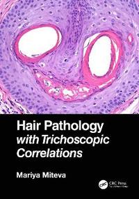 bokomslag Hair Pathology with Trichoscopic Correlations