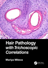 bokomslag Hair Pathology with Trichoscopic Correlations