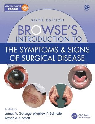 Browse's Introduction to the Symptoms & Signs of Surgical Disease 1