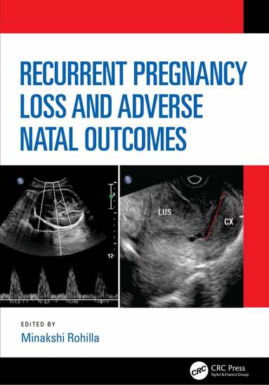 Minakshi Rohilla - Recurrent Pregnancy Loss and Adverse Natal Outcomes, Inbunden