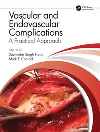 bokomslag Vascular and Endovascular Complications: A Practical Approach