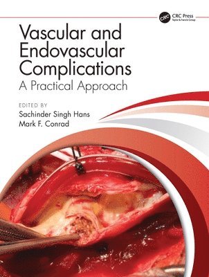 Vascular and Endovascular Complications: A Practical Approach 1