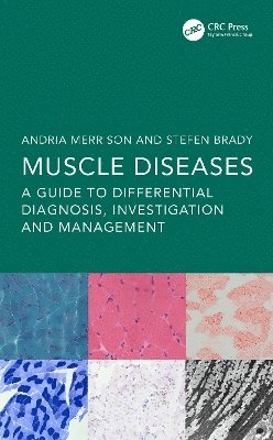 Muscle Diseases 1