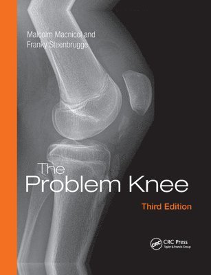 bokomslag The Problem Knee