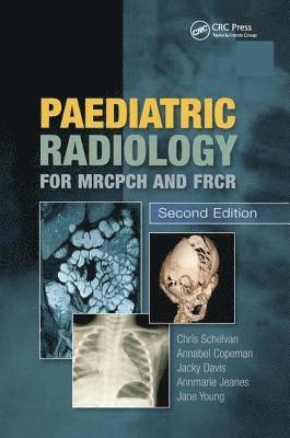 Paediatric Radiology for MRCPCH and FRCR, Second Edition 1