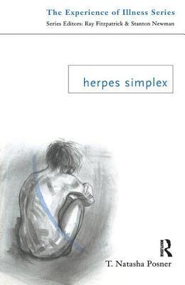 Herpes Simplex 1