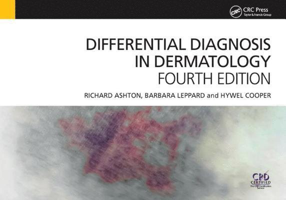 Differential Diagnosis in Dermatology 1