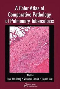 bokomslag A Color Atlas of Comparative Pathology of Pulmonary Tuberculosis