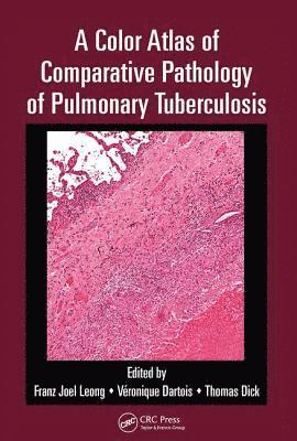 A Color Atlas of Comparative Pathology of Pulmonary Tuberculosis 1