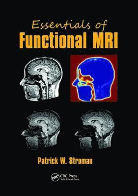 bokomslag Essentials of Functional MRI