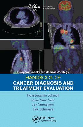 Hans-Joachim Schmoll, Laura Van't Meer, Jan Vermorken, Dirk Schrijvers - ESMO Handbook of Cancer Diagnosis and Treatment Evaluation, Inbunden
