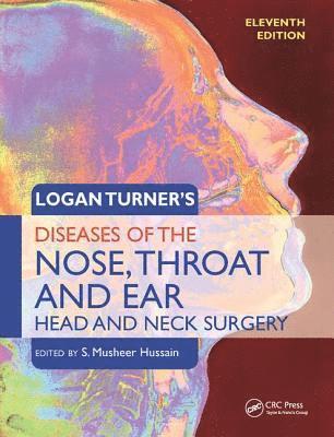 bokomslag Logan Turner's Diseases of the Nose, Throat and Ear, Head and Neck Surgery