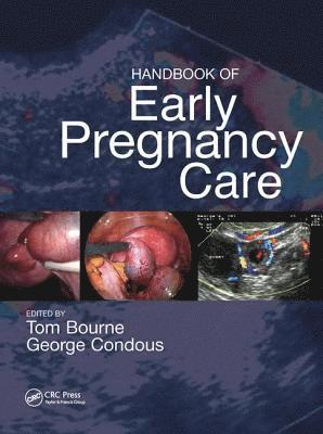 bokomslag Handbook of Early Pregnancy Care