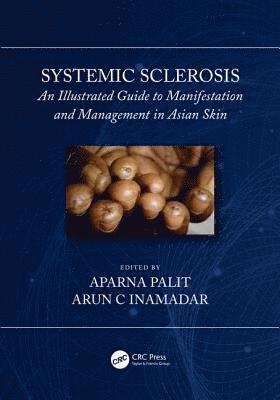 Arun C Inamadar, Aparna Palit, Arun C. Inamadar - Systemic Sclerosis, Inbunden