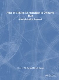bokomslag Atlas of Clinical Dermatology in Coloured Skin