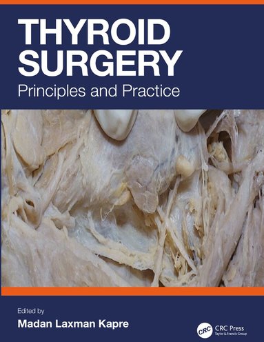 Madan Kapre - Thyroid Surgery, Inbunden