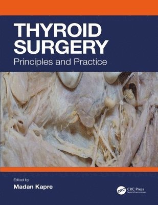 Thyroid Surgery 1