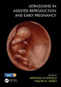 bokomslag Ultrasound in Assisted Reproduction and Early Pregnancy