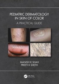 bokomslag Pediatric Dermatology in Skin of Color
