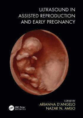 Ultrasound in Assisted Reproduction and Early Pregnancy 1