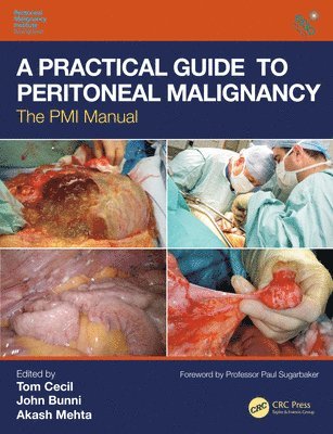 Tom Cecil, John Bunni, Akash Mehta, Oxford.) Cecil, Tom (Honorary Transplant Surgeon, Oxford University Hospitals, University of Bath.) Bunni, John (Honorary Lecturer, Cardiff University, Visiting Lecturer, UK.) Mehta, Akash (Consultant Colorectal Surgeon, St Mark’s Hospital & Academic Institute, London - Practical Guide to Peritoneal Malignancy, Inbunden