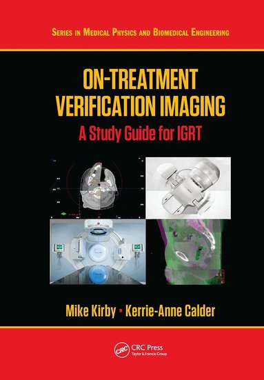 Mike Kirby, Kerrie-Anne Calder - On-Treatment Verification Imaging, Inbunden
