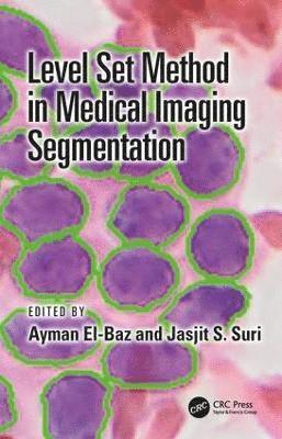 Level Set Method in Medical Imaging Segmentation 1