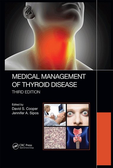 David S. Cooper, Jennifer Sipos - Medical Management of Thyroid Disease, Third Edition, Inbunden