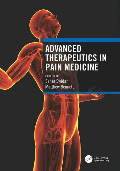 Sahar Swidan, Matthew Bennett - Advanced Therapeutics in Pain Medicine, Inbunden