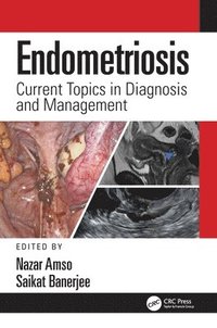 bokomslag Endometriosis