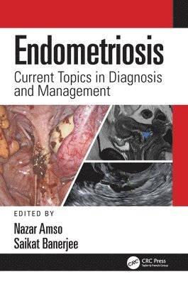 bokomslag Endometriosis