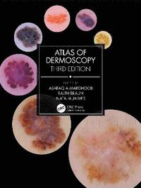 bokomslag Atlas of Dermoscopy