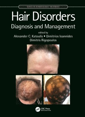 bokomslag Hair Disorders