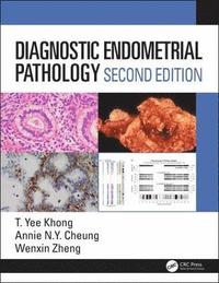 bokomslag Diagnostic Endometrial Pathology 2E