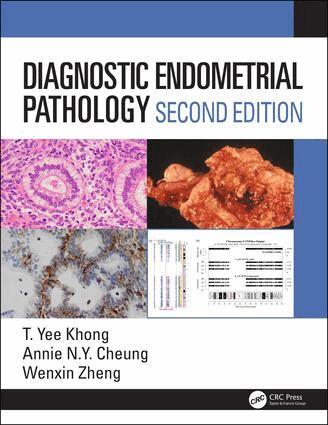 Yee Khong, Annie NY Cheung, Wenxin Zheng - Diagnostic Endometrial Pathology 2E, Inbunden