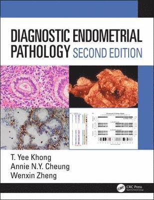 Diagnostic Endometrial Pathology 2E 1