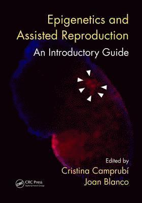 Epigenetics and Assisted Reproduction 1