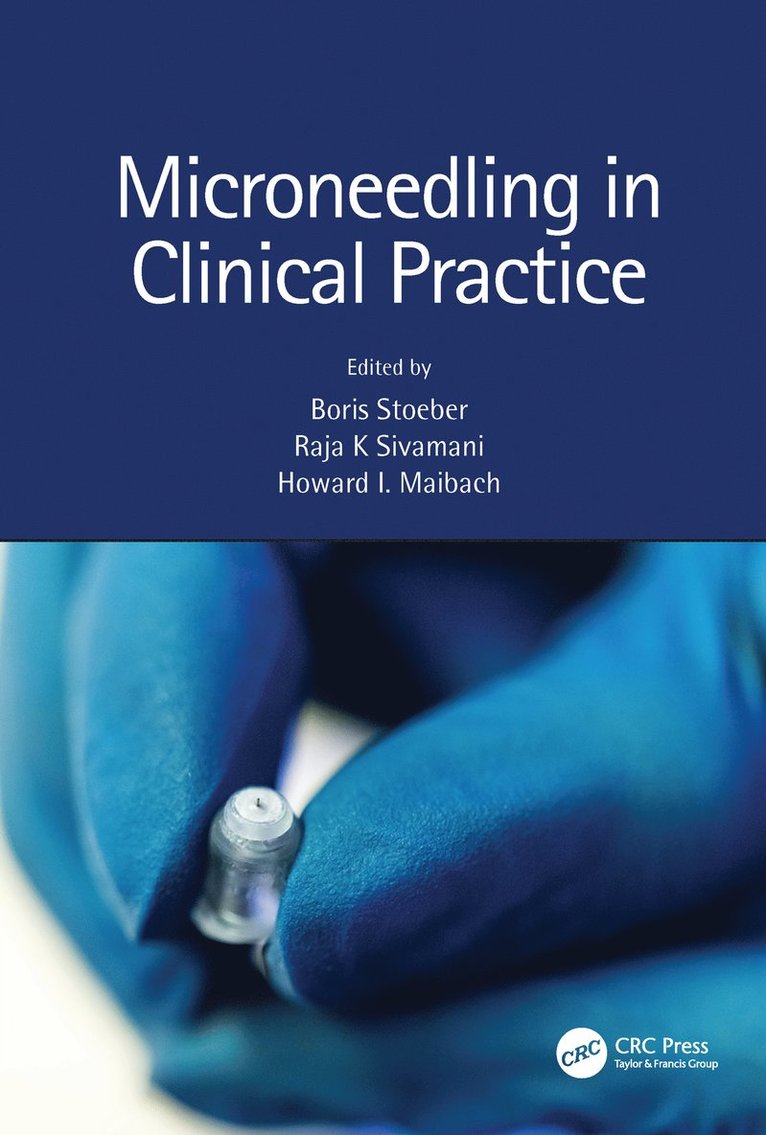 Boris Stoeber, Raja K. Sivamani, Howard Maibach, Canada) Stoeber, Boris (The University of British Columbia, USA) Sivamani, Raja K. (University of California, USA.) Maibach, Howard (University of California - Microneedling in Clinical Practice, Inbunden