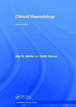 Atul Bhanu Mehta, Keith Gomez - Clinical Haematology, Inbunden