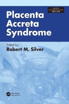 bokomslag Placenta Accreta Syndrome