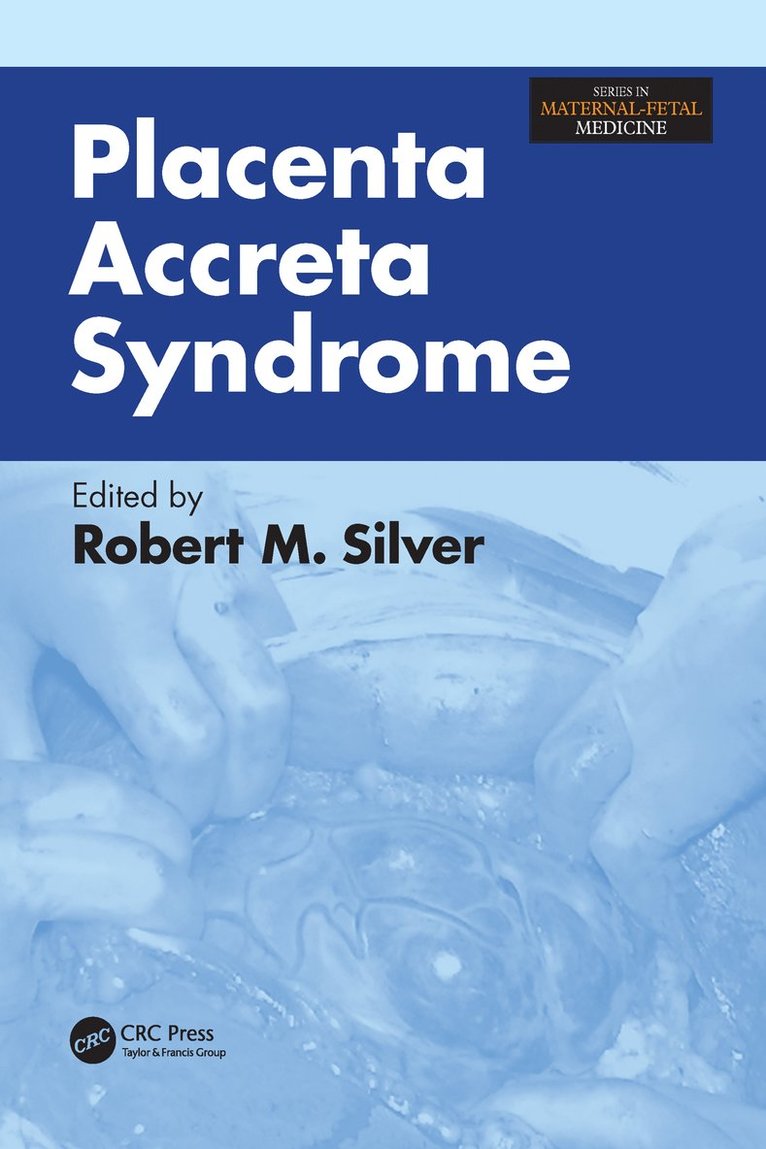 Placenta Accreta Syndrome 1