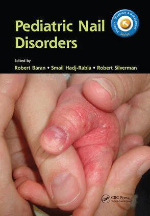 Robert Baran, Smail Hadj-Rabia, Robert Silverman - Pediatric Nail Disorders, Inbunden