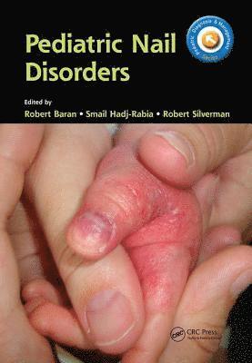 bokomslag Pediatric Nail Disorders